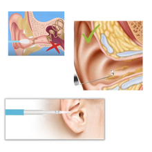 Carica l'immagine nel visualizzatore di Gallery, 3 in 1 Telecamera auricolare - Ozerty
