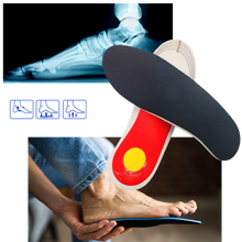 Carica l'immagine nel visualizzatore di Gallery, 1 paio di solette per l'arco plantare per piedi piatti - Ozerty
